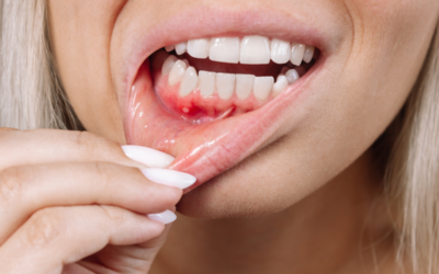 Understanding the Causes of Gums Pain