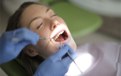 What is the Procedure for Whitening Teeth?