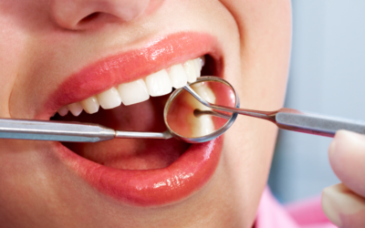 How to Find Cheap Dental Care Services in Dublin