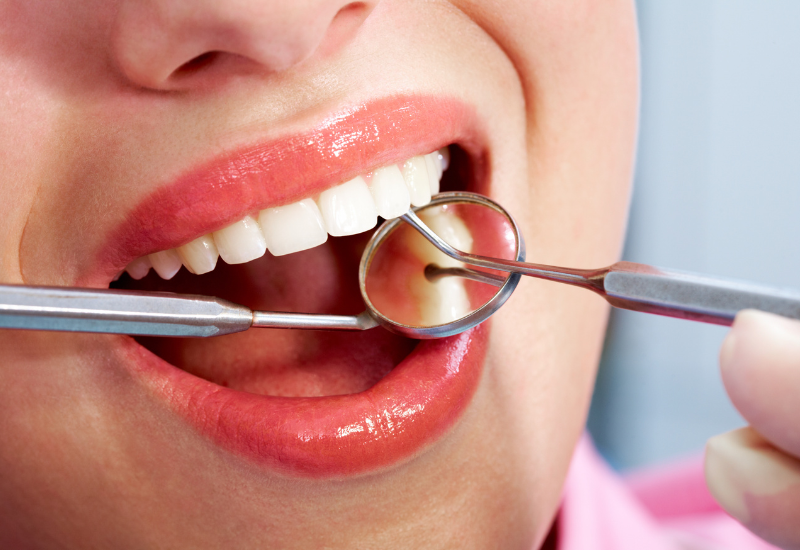 How to Find Cheap Dental Care Services in Dublin